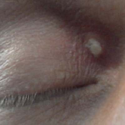 client treatment 1